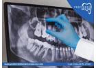 Relieve Pain with Expert Root Canal Near Me In Davie