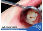 Revitalize Your Oral Health with Effective Cavity Protection Service!