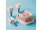 Shop Dental Implant Components Wholesale at Great Prices