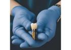 Reliable Dental Implant Products Wholesale for Clinics