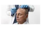 Hair Restoration Experts in Mumbai