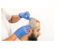 Affordable Hair Transplant near Mumbai