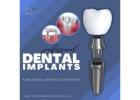 Restore Your Smile with Dental Implants in Summerlin!