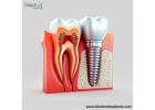 Best Selling Private Label Implants In Peru - Go Global