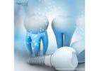 Siiodent Implants: OEM Partners in Mexico for 2025 Growth
