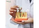 Siiodent Implants: Dental Implant Manufacturers In Honduras