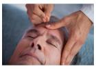 Acupuncture Treatment Thornhill: For Natural Healing