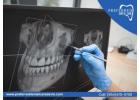 Dental X-Ray Clinic Near Me – Discover Your Smile
