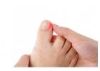 Advanced Wound Care in Belle Glade & Royal Palm Beach