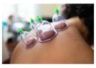 Cupping Therapy: Boosts Recovery, Reduces Tension, and Enhances Blood Flow