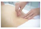 Bryant Park Acupuncture & Holistic Wellness in Midtown NYC - Grand Madison Acupuncture