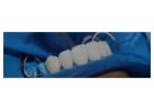 Dental implants Tijuana offers natural-looking and durable teeth replacements