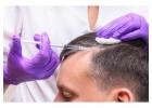 Exosomes Hair Therapy in Islamabad