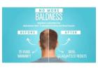 Restore Your Hair and Confidence with New Touch Hair Transplant Clinic Ahmedabad