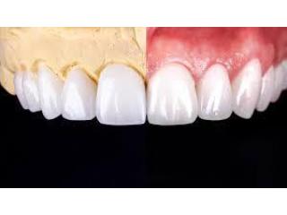 Get Your Perfect Smile by Treating from Dentist in Tijuana Get Your Perfect Smile by Treating from Dentist in Tijuana