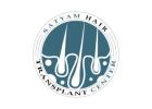 Hair Transplant in Ludhiana