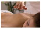 Acupuncture Treatment Toronto: Traditional Healing Designed For Balanced, Restorative Wellness Suppo