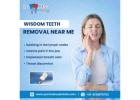Wisdom Teeth Removal Near Me for Safe and Comfortable Treatment