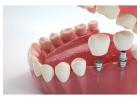 Dental Implants in Northeast Philadelphia for Long Lasting Natural Looking Smiles