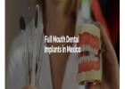 Full Mouth Dental Implants in Mexico with Teeth Savers