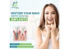 Dental Implants Near Gaur City for Smile Restoration
