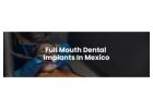 Full Mouth Dental Implants in Mexico with Teeth Savers