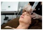 Fractionated CO2 Laser for Acne Scars & Pigmentation in Altamonte Springs, Orlando, Daytona Beach &