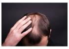 QR678 Hair Treatment in Pune for Hair Loss and Regrowth Support