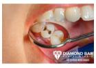 Emergency Dentist Diamond Bar | Affordable Dental Care Call Today