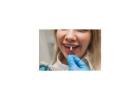 Porcelain Veneers in Frisco
