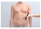 Abdominoplasty in Islamabad