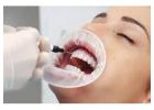 Finding Relief: Best Treatments for Sensitive Teeth in Ballarat