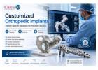 Patient-Specific Customized Orthopedic Implants for Better Outcomes