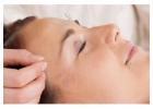 Workplace Wellness Services NYC | Acupuncture for Corporate Events