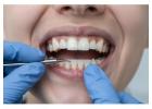 General Dentistry in San Antonio, TX