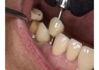 Trusted Dental Clinic in Tijuana – Comprehensive Care for a Brighter, Healthier Smile