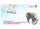 Customized Orthopedic Implants for Complex Bone Surgeries
