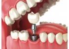 Trusted Dentist in Abbotsford | Your Local Dentist Near Me