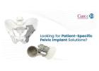 Patient-Specific PSI Implant Manufacturer for Complex Surgeries