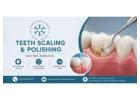 Teeth Scaling and Polishing in Islamabad