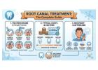 Root Canal Treatment in Abbotsford | Save Your Natural Tooth