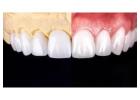 Get Your Perfect Smile by Treating from Dentist in Tijuana